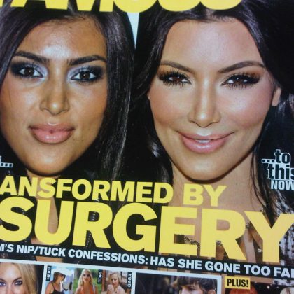 Vai de botox?
