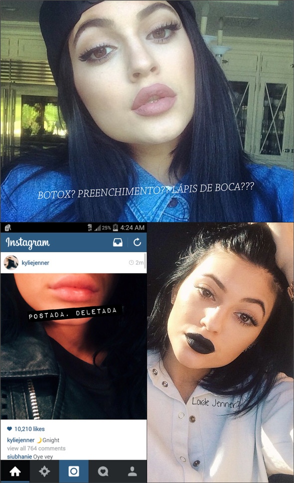 KYLIE-JENNER-LABIOS-LIPS