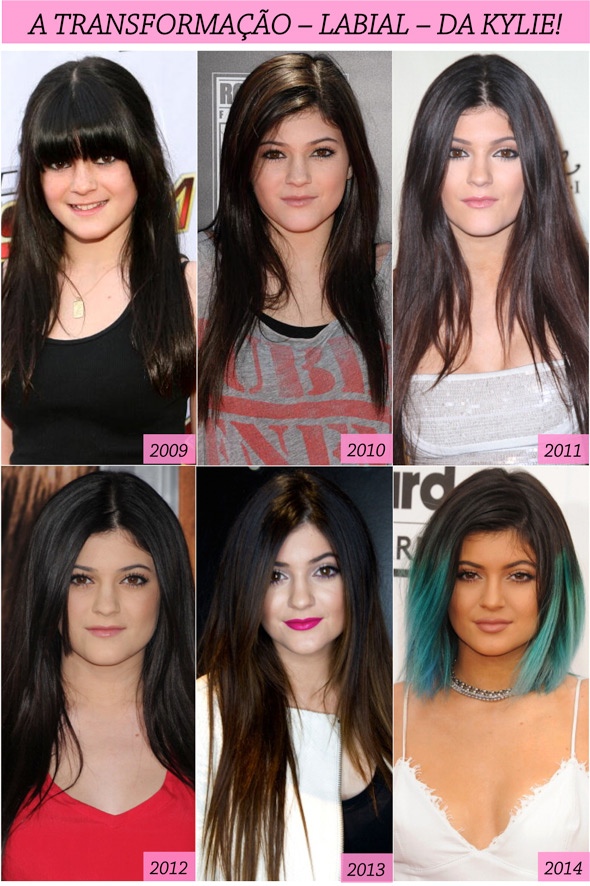 KYLIE-JENNER-TRANSFORMATION