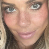 Sun stripping, moda de beauté pra quando não rolar sol!